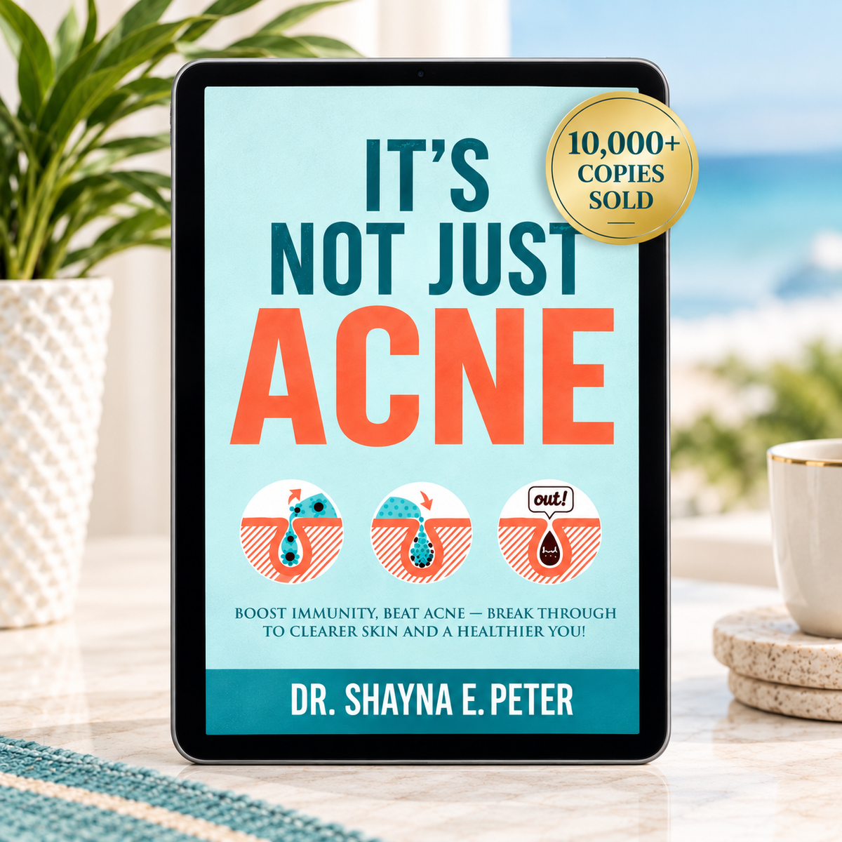 It's Not Just Acne - Ebook