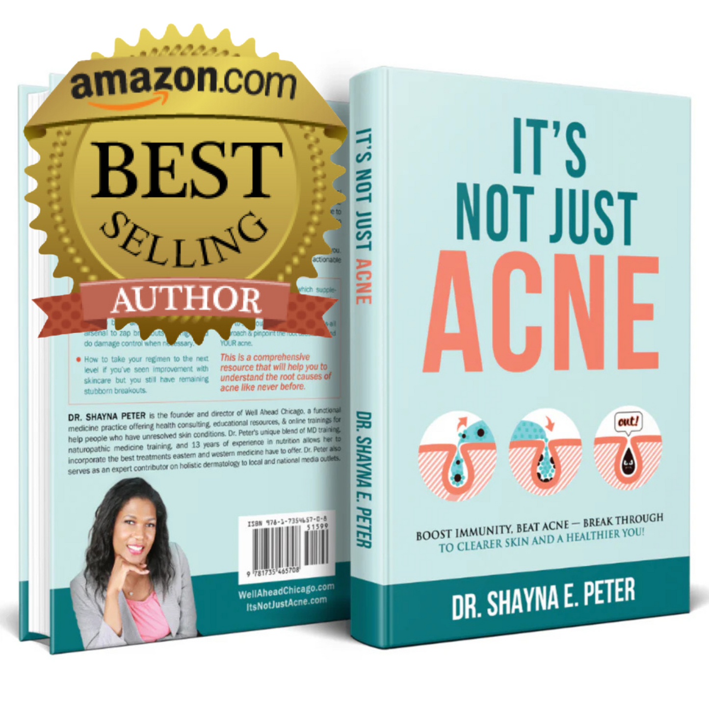 The Acne Solution Set