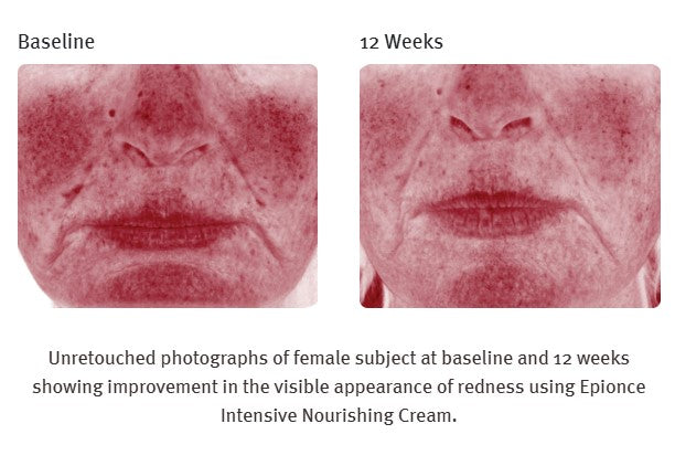 Intensive Nourishing Night Cream (All Skin Types: Face, Neck, & Décolletage)