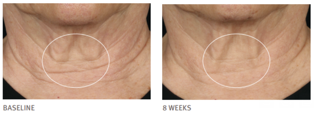 Intensive Nourishing Night Cream (All Skin Types: Face, Neck, & Décolletage)