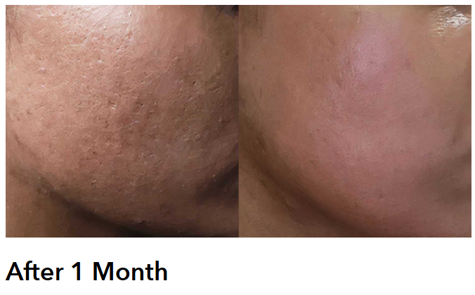 AnteAge Pro Growth Factor System