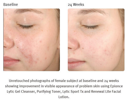 Lytic Sport Tx