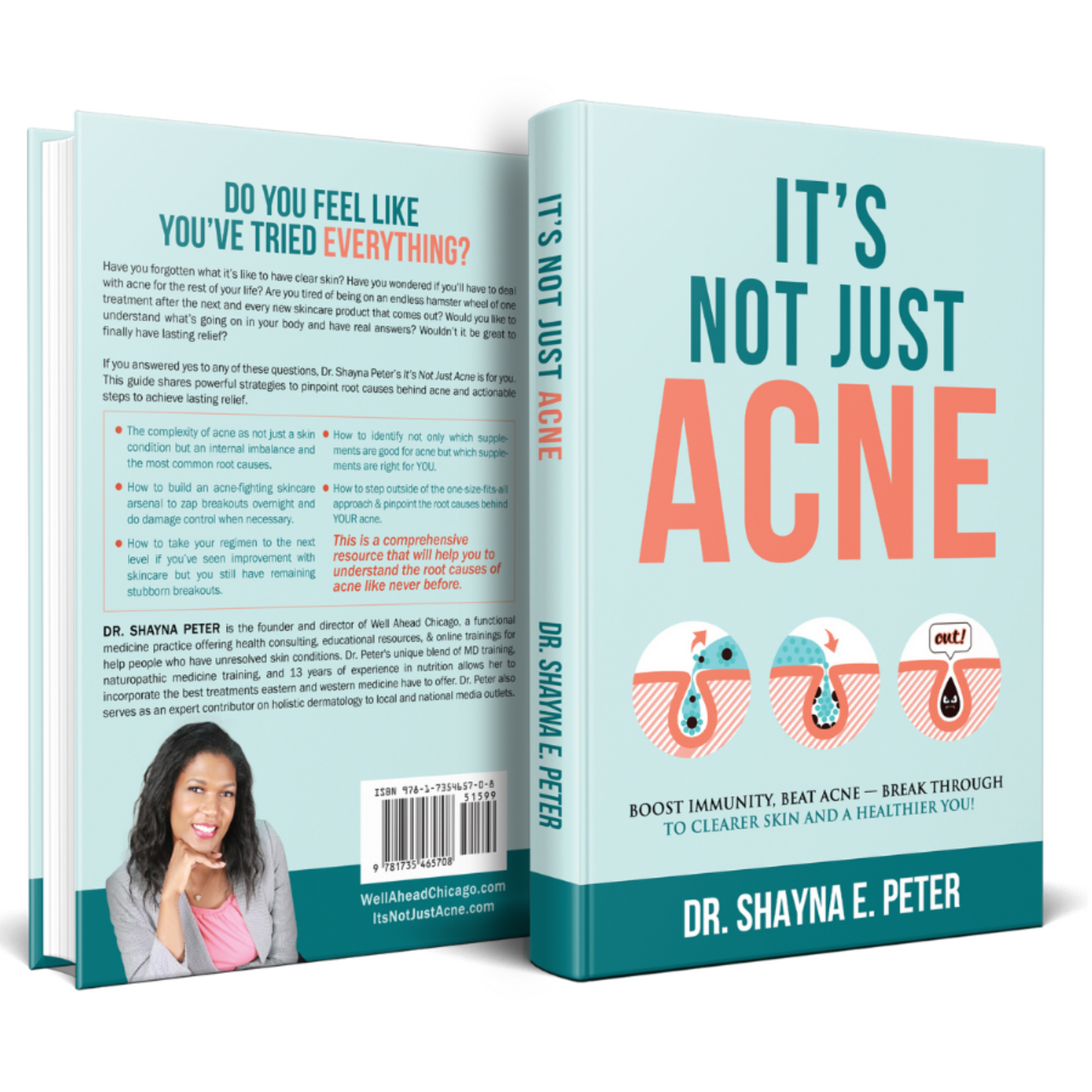 It's Not Just Acne - Paperback