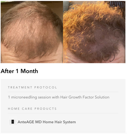 Complete Hair & Skin Restoration Set