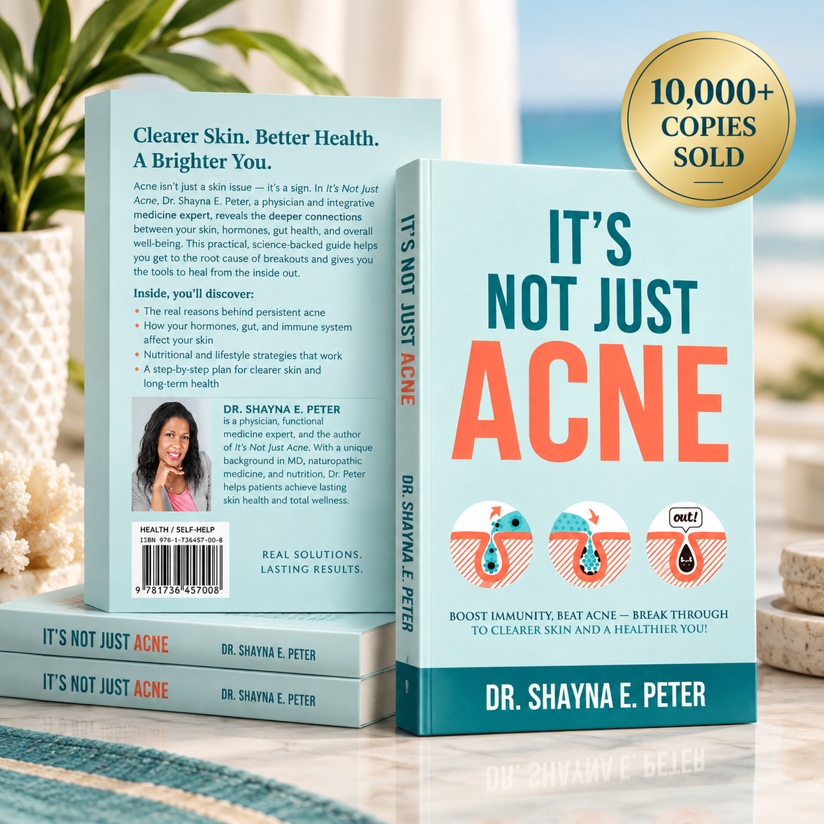 It's Not Just Acne - Paperback